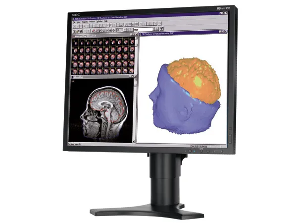 NEC MDview 193 https://www.monitor-information.de/wp-content/uploads/image_cache/0138B7E399F011EE8E1900163E51D9F2/5a2429d0ed59476d4049490574b13364.webp