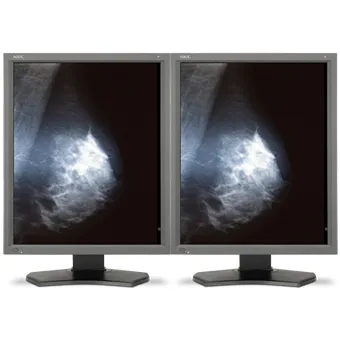 NEC MDG5-BNDN1 https://www.monitor-information.de/wp-content/uploads/image_cache/334498EE99F011EE8E1900163E51D9F2/b7605daf51959adffa21a01b57f44b82.webp