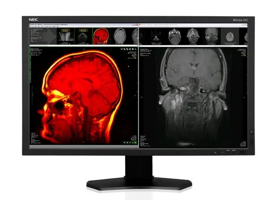 NEC MDVIEW 243 https://www.monitor-information.de/wp-content/uploads/image_cache/3D45CB7799F011EE8E1900163E51D9F2/585ba72007f2687ac3f8ff775495abd5.webp NEC MDVIEW 243 https://www.monitor-information.de/wp-content/uploads/image_cache/3D45CB7799F011EE8E1900163E51D9F2/585ba72007f2687ac3f8ff775495abd5.webp