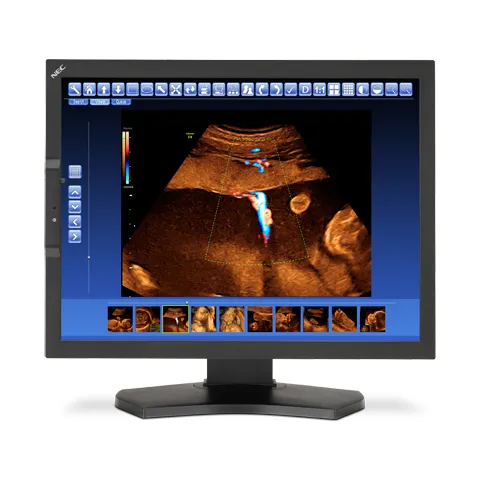 NEC MD210C2 https://www.monitor-information.de/wp-content/uploads/image_cache/3FBCA8D399F011EE8E1900163E51D9F2/6a81a359204cbb11ec2109b4cceb94a5.webp