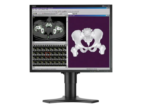 NEC MDview 202 https://www.monitor-information.de/wp-content/uploads/image_cache/FDF50B3B99EF11EE8E1900163E51D9F2/34801a1ba0dfb7c1914b13d7a0d4f901.webp
