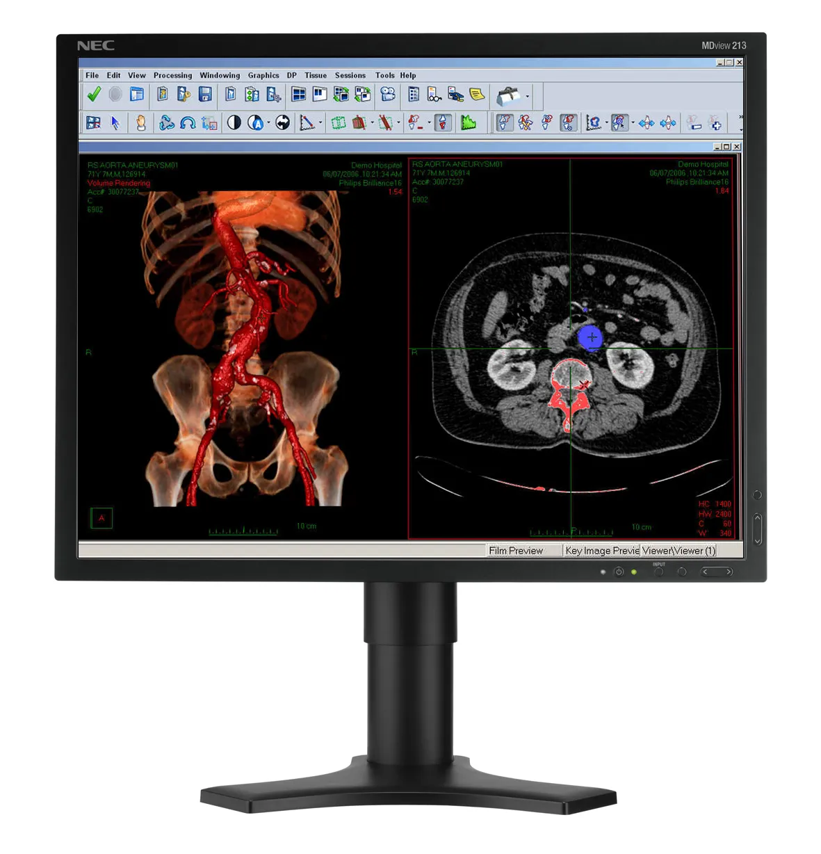 NEC MDview 213 https://www.monitor-information.de/wp-content/uploads/image_cache/FDF5AC6799EF11EE8E1900163E51D9F2/b9dabf1da1bb84d76b664933c29d0b87.webp